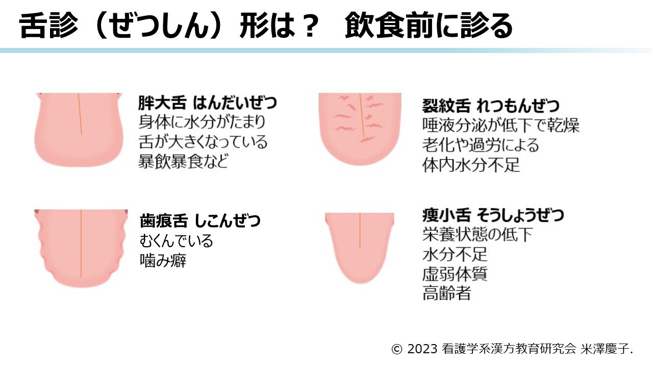 漢方医学の診断法 | ツムラ医療関係者向けサイト | 株式会社ツムラ