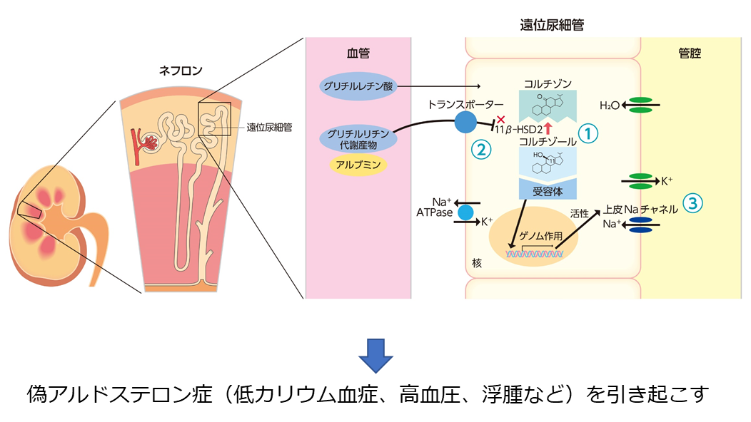 高アルドステロン症と低アルドステロン症の症状