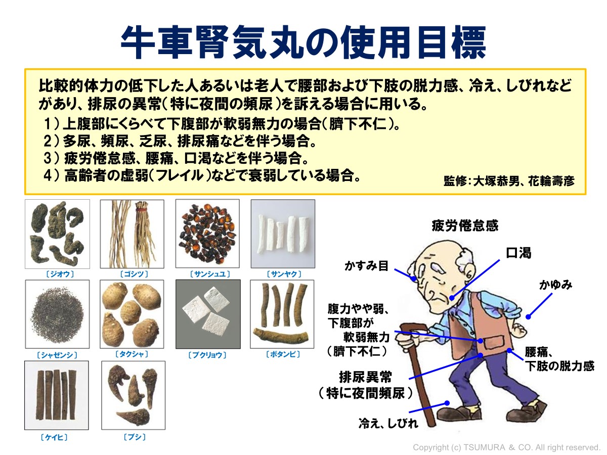 夜叉丸様確認用 キングジム 角につけるお知らせライト TAL40 KING JIM 衝突防止