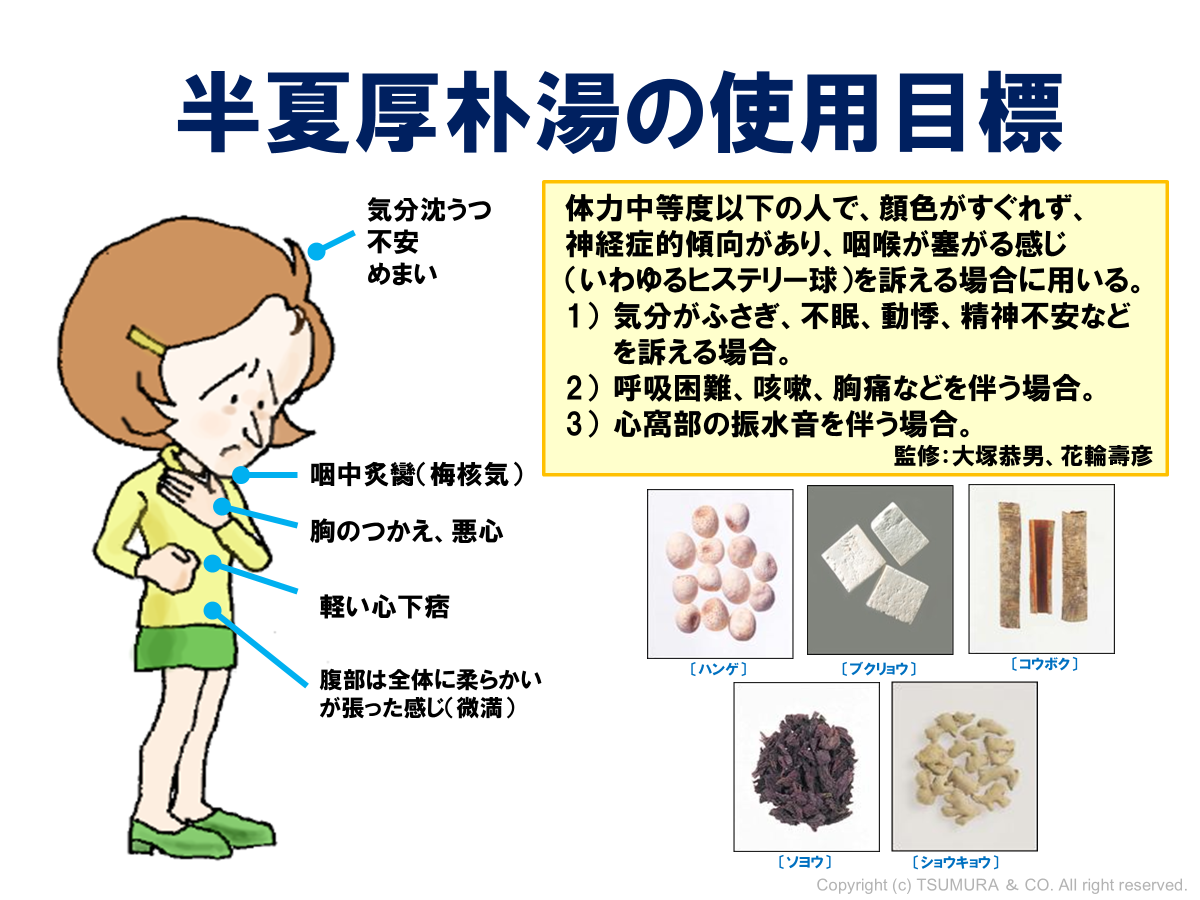 半夏厚朴湯の処方解説 | ツムラ医療関係者向けサイト | 株式会社ツムラ