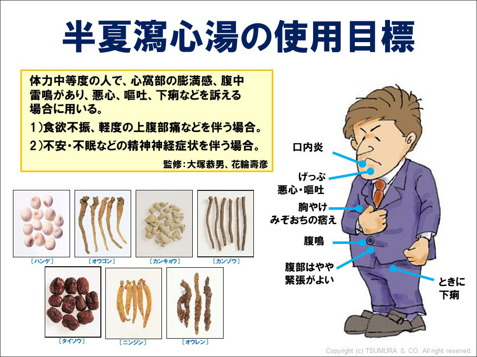 半夏瀉心湯作用機序 – 半夏瀉心湯 口内炎 うがい – EXYB