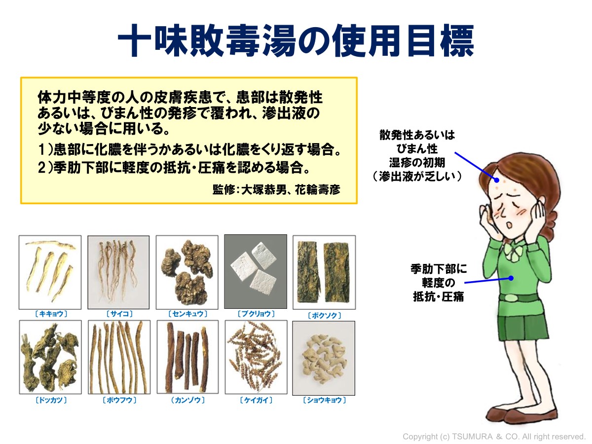 中医処方解説 十味敗毒湯の処方解説 | ツムラ医療関係者向けサイト | 株式会社ツムラ