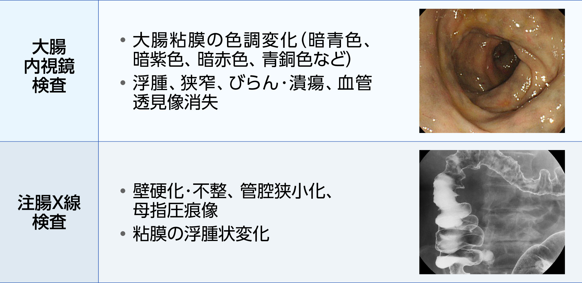 腸間膜静脈血栓症の診断