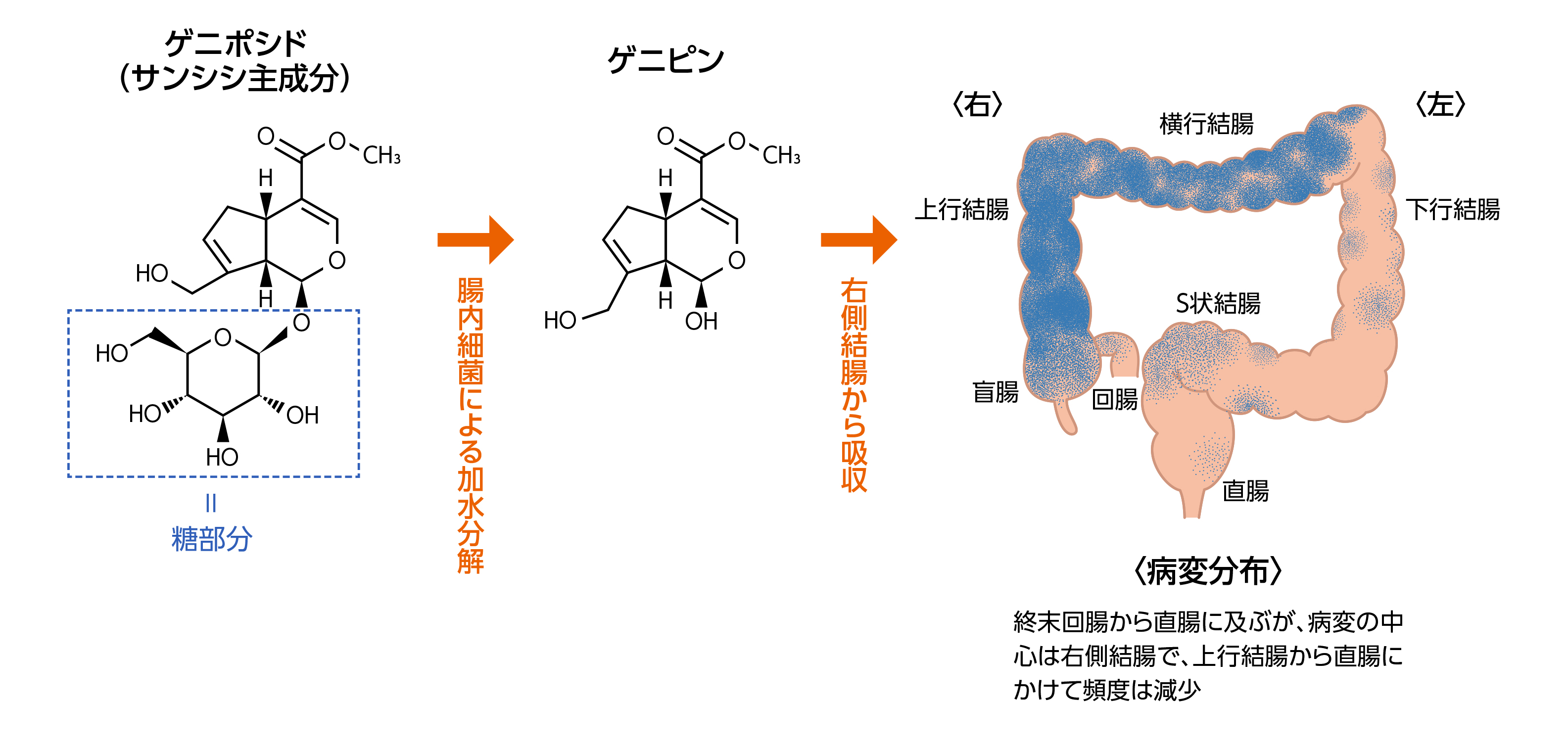 腸間膜静脈硬化症 ツムラ医療関係者向けサイト 株式会社ツムラ 